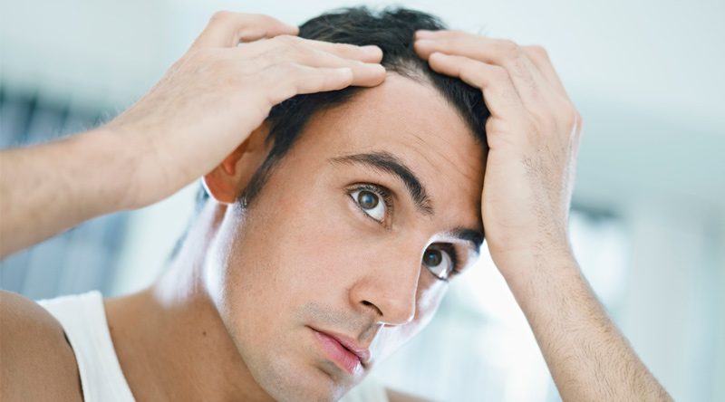 Motivos de queda de cabelo: Stress, hormônios e má alimentação?