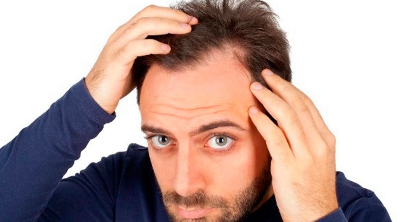 Queda de cabelo: lavar a cabeça todos os dias faz o cabelo cair?